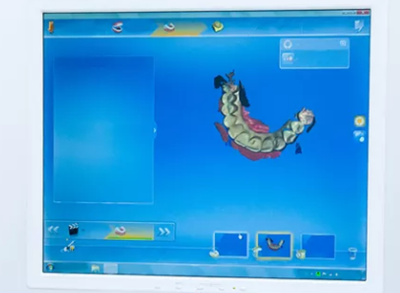 神奇的口腔「3D」 革命 神奇的口腔「3D」 革命