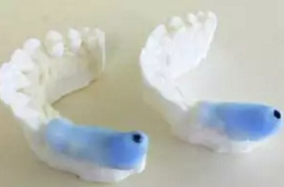 神奇的口腔「3D」 革命 神奇的口腔「3D」 革命