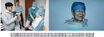 病例報(bào)道│全程數(shù)字化輔助無牙頜種植即刻負(fù)重 病例報(bào)道│全程數(shù)字化輔助無牙頜種植即刻負(fù)重