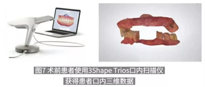 病例報(bào)道│全程數(shù)字化輔助無牙頜種植即刻負(fù)重 病例報(bào)道│全程數(shù)字化輔助無牙頜種植即刻負(fù)重