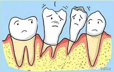 上海嘉?？谇谎芯克皇兰o(jì)牙周病的臨床進(jìn)展