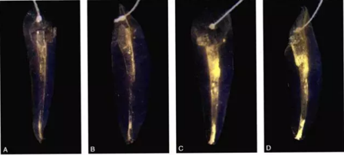 (十一期)根管充填物的清理-牙膠的去除 (十一期)根管充填物的清理-牙膠的去除