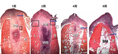 血液衍生物PRF&CGF在牙槽窩處理中的應(yīng)用 血液衍生物PRF&CGF在牙槽窩處理中的應(yīng)用