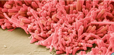 牙菌斑是什么？