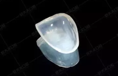 瓷貼面修復(fù)體最終顏色的影響因素 瓷貼面修復(fù)體最終顏色的影響因素