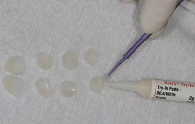 瓷貼面修復(fù)體最終顏色的影響因素 瓷貼面修復(fù)體最終顏色的影響因素