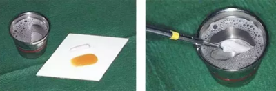 【牙周外科的基本技術技能】術后管理 【牙周外科的基本技術技能】術后管理