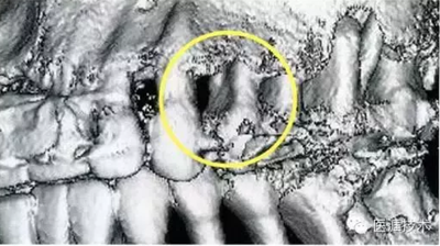 【牙周外科】牙齒的解剖形態(tài)(上篇) 【牙周外科】牙齒的解剖形態(tài)(上篇)
