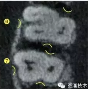 【牙周外科】牙齒的解剖形態(tài)(上篇) 【牙周外科】牙齒的解剖形態(tài)(上篇)