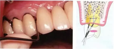 【牙周外科】牙齒的解剖形態(tài)(上篇) 【牙周外科】牙齒的解剖形態(tài)(上篇)