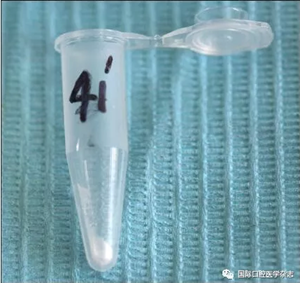 根管預備系統 根管預備系統