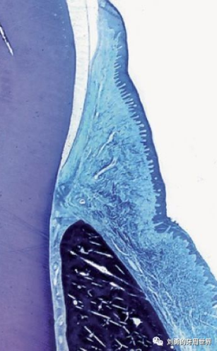 牙周解剖(一):角化齦和附著齦爭(zhēng)議總結(jié) 牙周解剖(一):角化齦和附著齦爭(zhēng)議總結(jié)