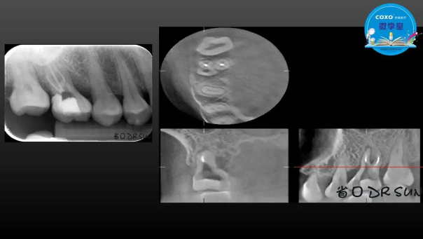 (第二十五期)微學(xué)堂回顧 (第二十五期)微學(xué)堂回顧