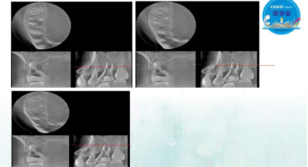 (第二十五期)微學(xué)堂回顧 (第二十五期)微學(xué)堂回顧