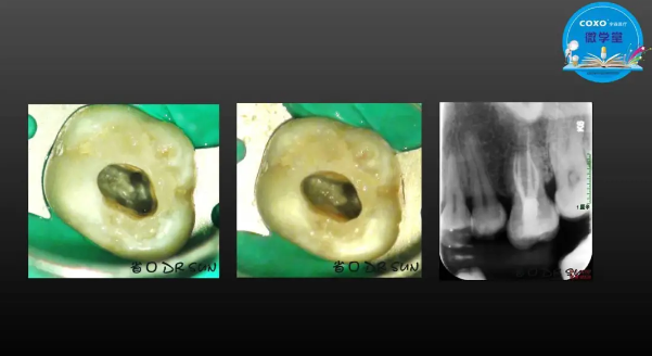 (第二十五期)微學(xué)堂回顧 (第二十五期)微學(xué)堂回顧