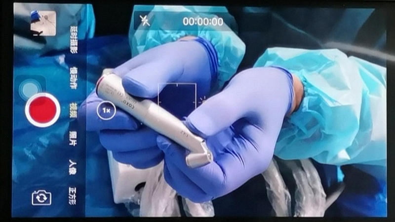 宇森電動(dòng)馬達(dá)微創(chuàng)拔牙 宇森電動(dòng)馬達(dá)微創(chuàng)拔牙