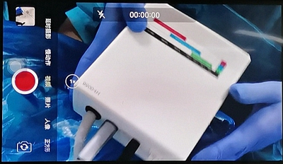 宇森電動(dòng)馬達(dá)微創(chuàng)拔牙 宇森電動(dòng)馬達(dá)微創(chuàng)拔牙