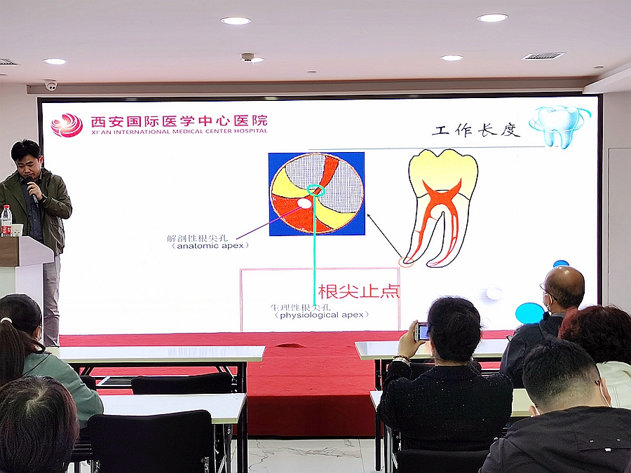 根尖止點 根尖止點