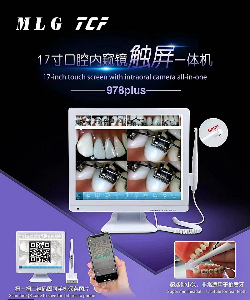 美力光內(nèi)窺鏡 美力光內(nèi)窺鏡