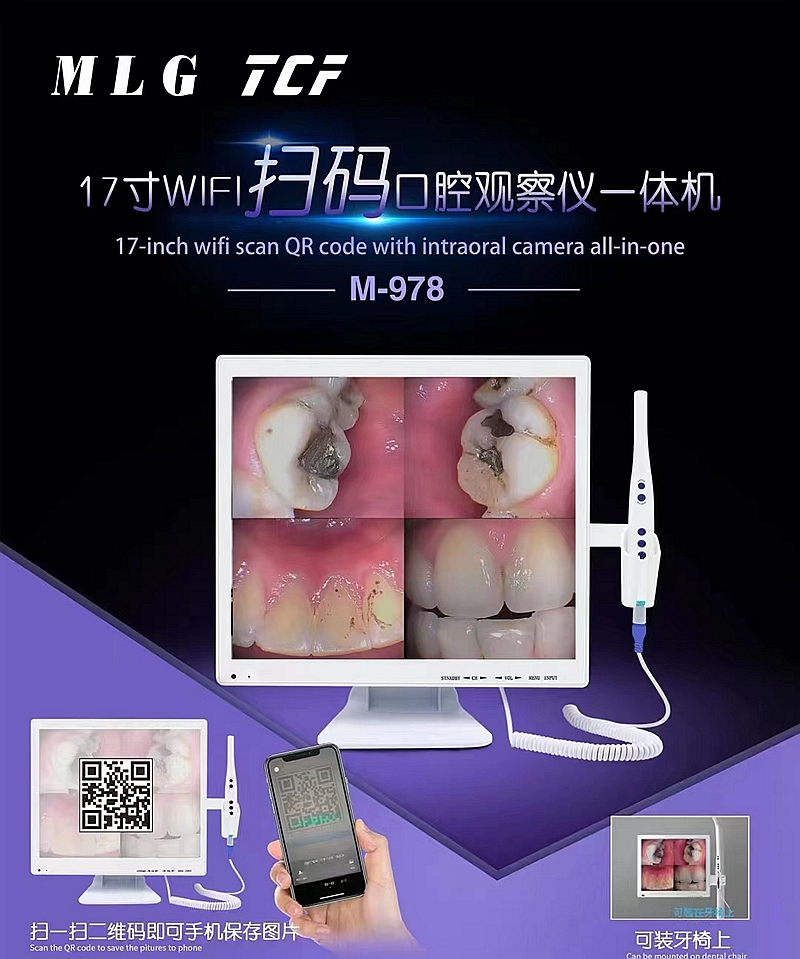 美力光內(nèi)窺鏡 美力光內(nèi)窺鏡