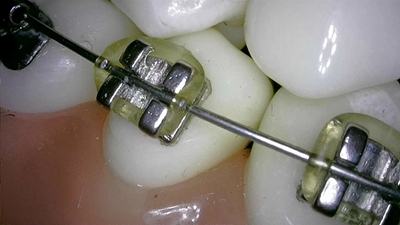 美力光口腔觀察儀內(nèi)窺鏡 美力光口腔觀察儀內(nèi)窺鏡