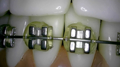 美力光口腔觀察儀內(nèi)窺鏡 美力光口腔觀察儀內(nèi)窺鏡