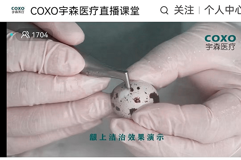 宇森口內(nèi)噴砂潔牙機(jī)CP-1新品發(fā)布 宇森口內(nèi)噴砂潔牙機(jī)CP-1新品發(fā)布