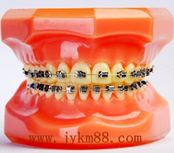 杰特全封閉型自鎖正畸托槽 杰特全封閉型自鎖正畸托槽